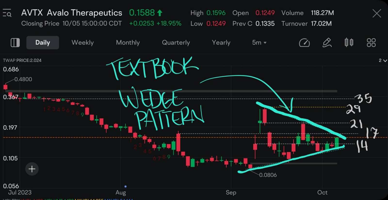 Is AVTX a Good Buy Right Now? - moomoo Community