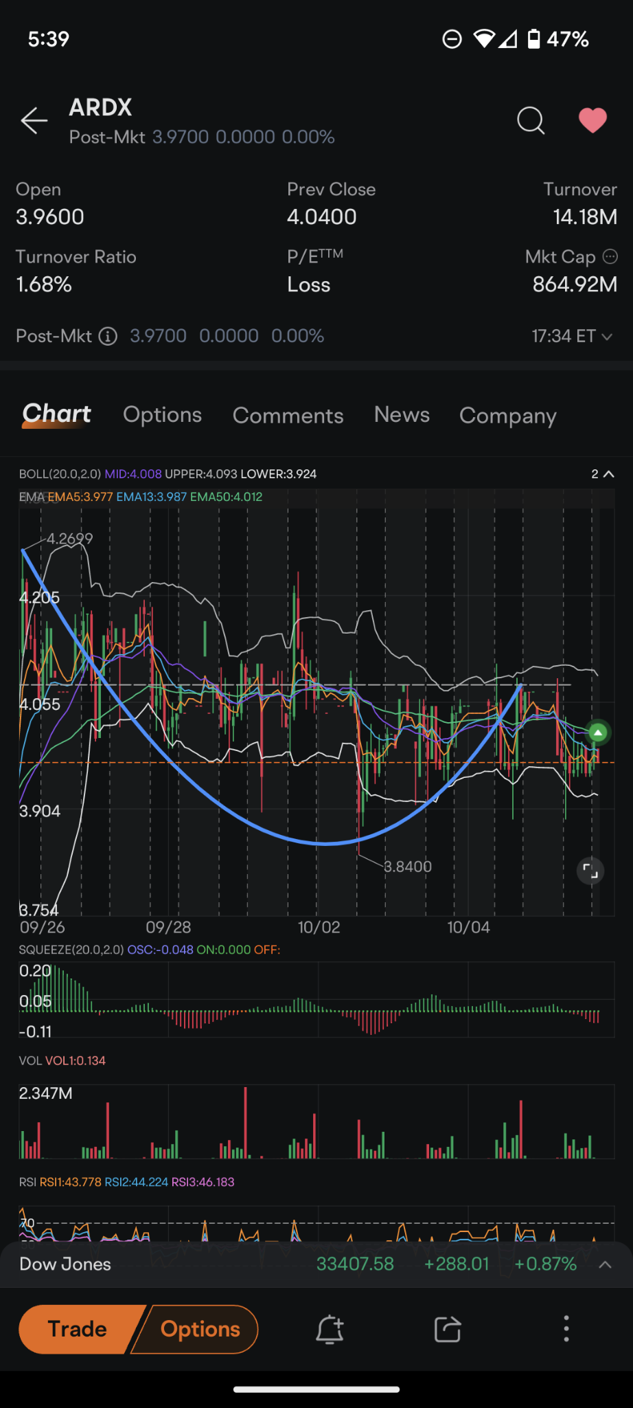 $Ardelyx (ARDX.US)$ 在1小时图上使用挤压监控