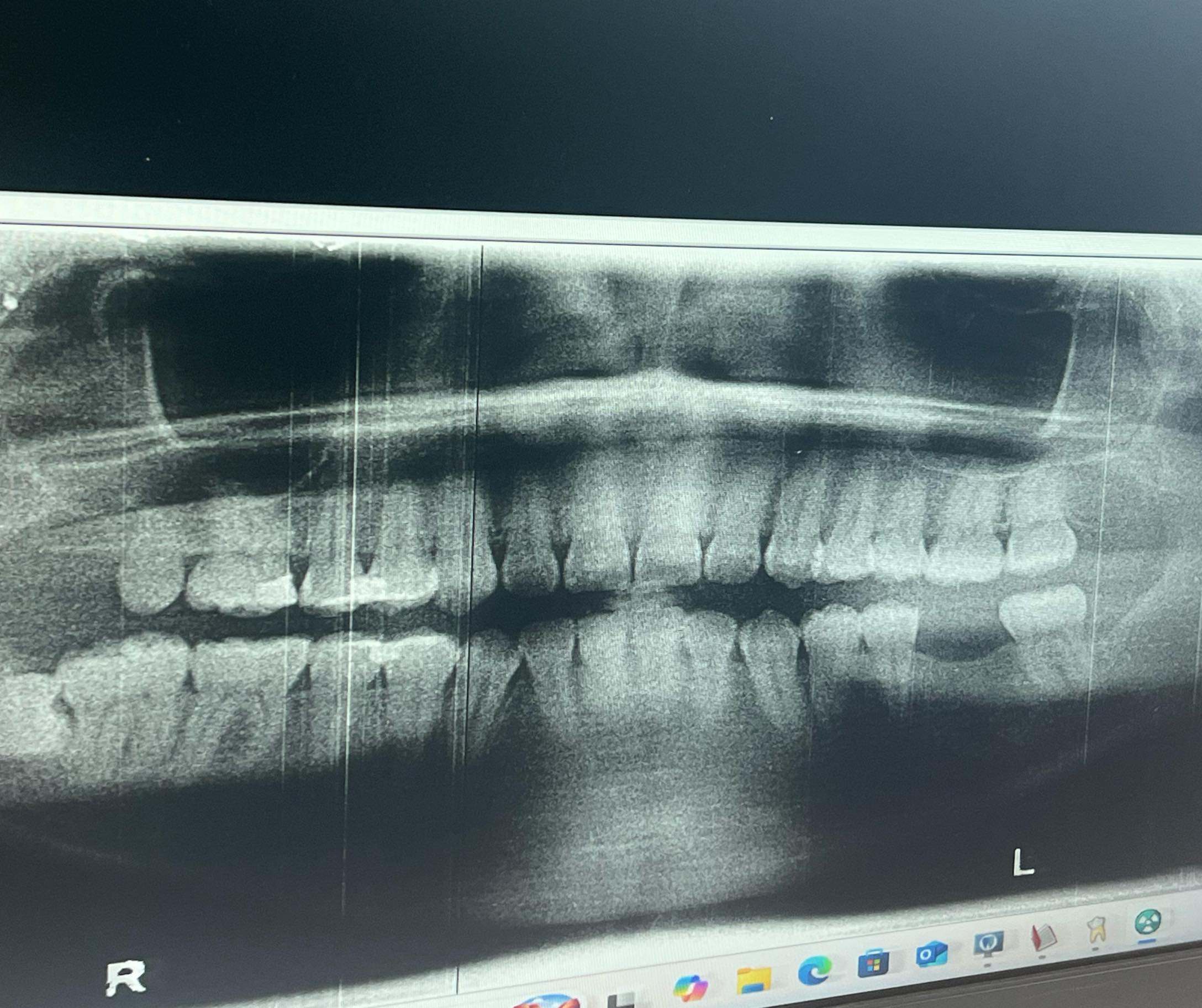 👀 Sandisk 🦷 🦷pain