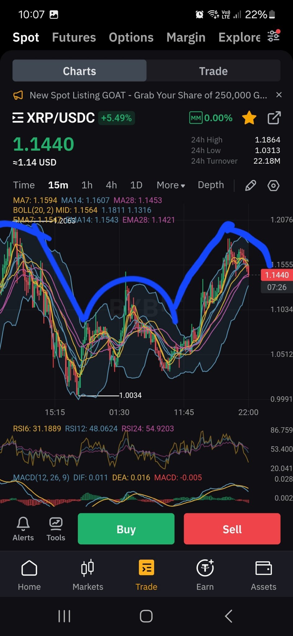 $XRP (XRP.CC)$ Massive head and shoulders forming.... Bullish!!!!