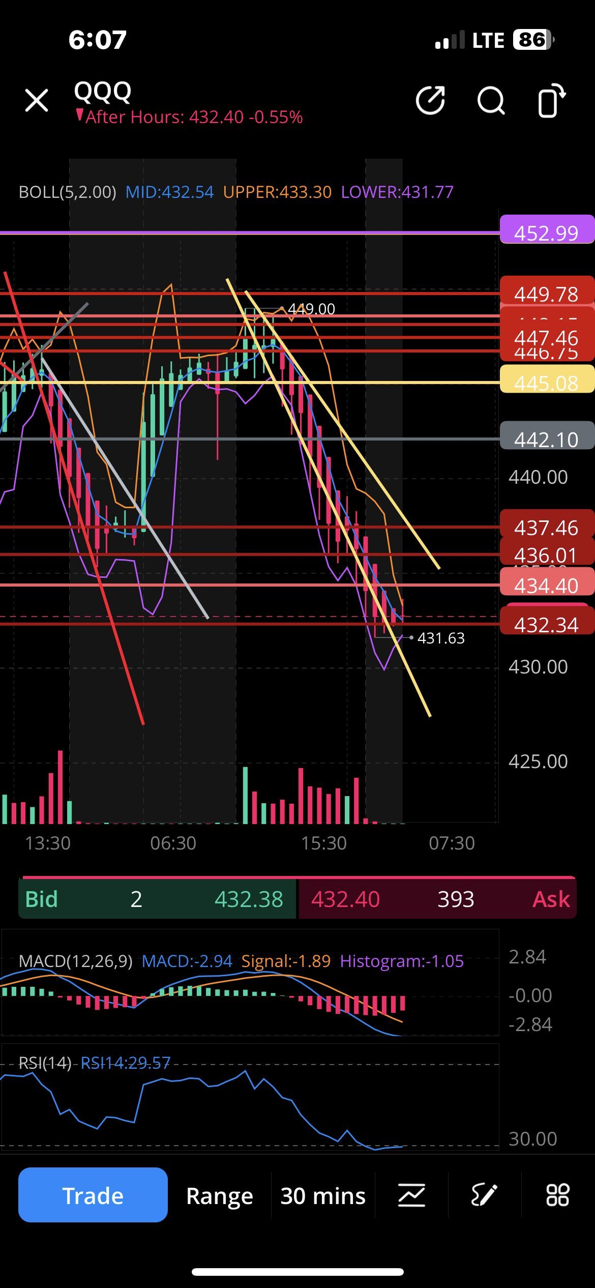 people always critic my chart but man if i didnt knock my goal post out the park for. made  so much money today lord 😮‍💨💰$NASDAQ 100 Index (.NDX.US)$  $Inves...